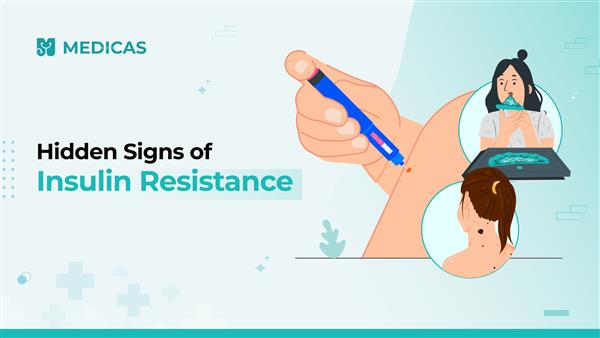 insulin resistance