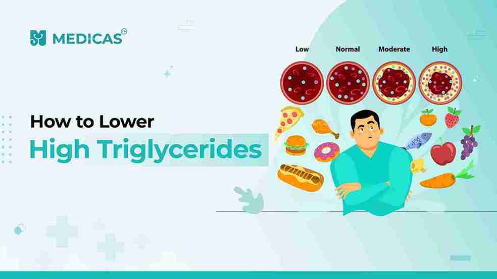 High Triglycerides Treatment